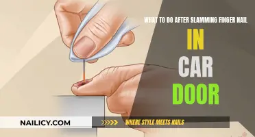 How to Treat a Finger Nail Slammed in a Car Door
