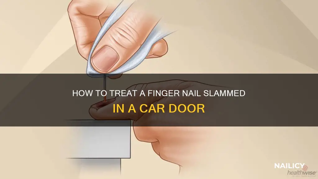 what to do after slamming finger nail in car door