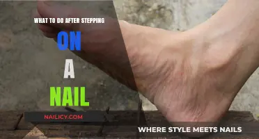 Immediate Steps to Take After Stepping on a Nail: Stay Safe