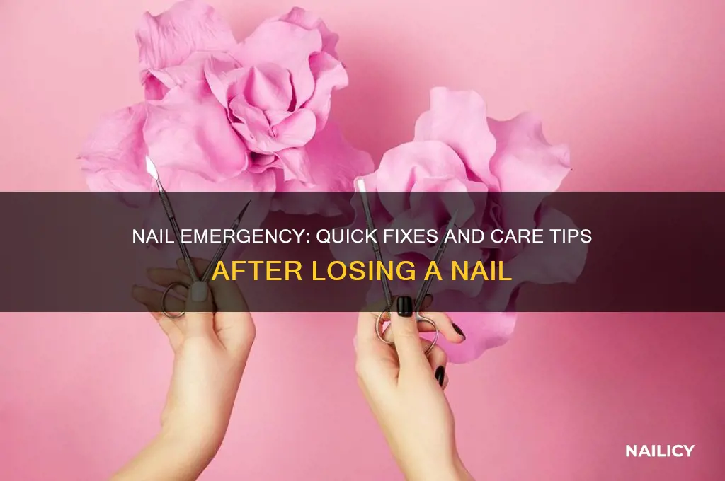 what to do after you lose a nail