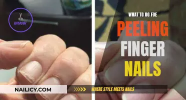 Nail Care 101: Effective Peeling Nail Solutions