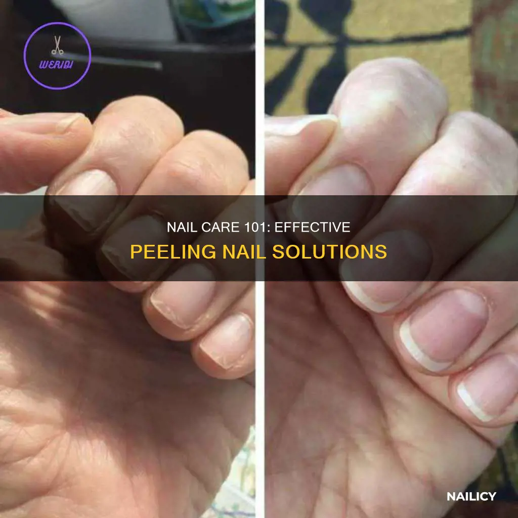 what to do foe peeling finger nails