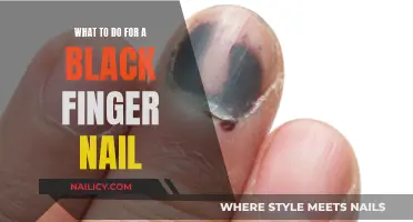 Black Nail Mystery: Causes and Quick Fixes