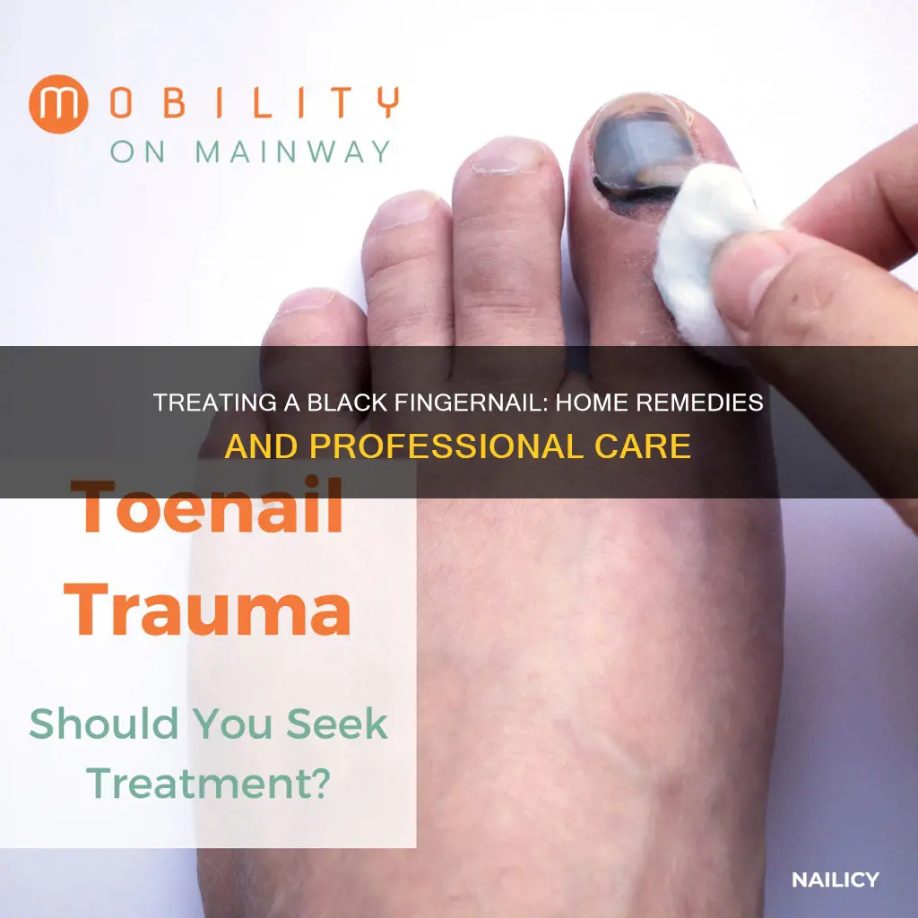 what to do for a black finger nail