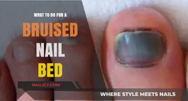 Healing a Bruised Nail Bed: Quick Remedies and Care Tips