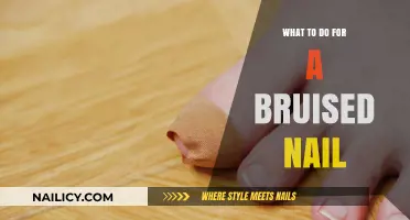 Effective Remedies and Care Tips for a Bruised Nail Recovery