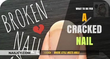 Quick Fixes for Cracked Nails: Repair and Strengthen Easily
