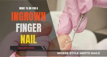 Ingrown Toenail Relief: Quick Fixes and Professional Help