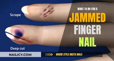 Quick Fixes for Jammed Finger Nails: Relief and Recovery