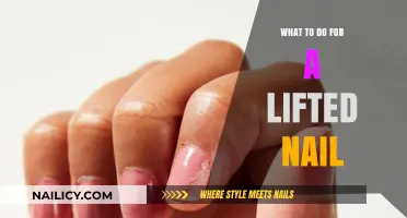 Quick Fixes and Care Tips for a Lifted Nail Emergency