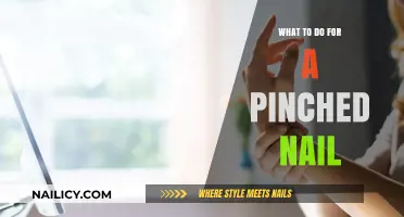 Quick Relief: Effective Remedies for a Painful Pinched Nail