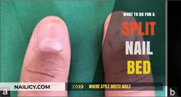 Quick Fixes and Care Tips for a Split Nail Bed