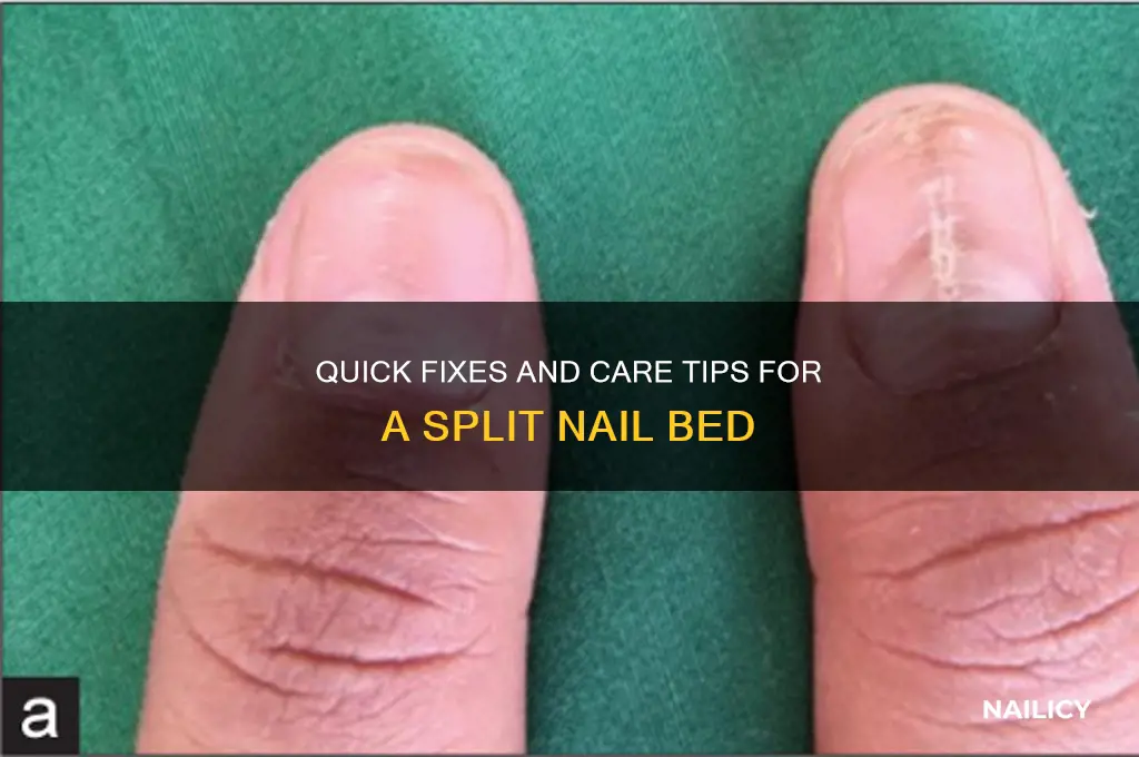 what to do for a split nail bed