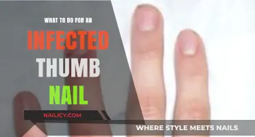 How to Treat an Infected Thumb Nail: Quick Relief Tips