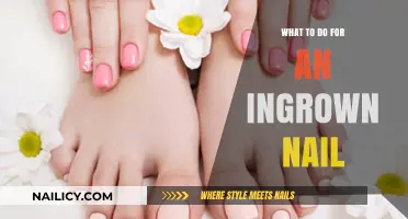 Effective Remedies and Prevention Tips for Painful Ingrown Nails
