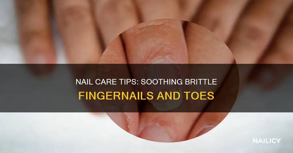 what to do for brittle finger and toe nails