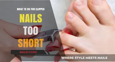 Ouch! Quick Fixes for Accidentally Clipped Nails Too Short