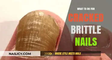 Nail Rescue: Effective Remedies for Cracked, Brittle Nails Revealed
