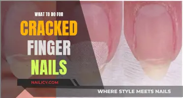 Fixing Cracked Fingernails: Quick Tips and Home Remedies