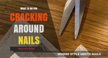 Effective Remedies for Cracking Around Nails: Restore Strength and Health
