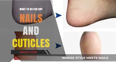 Hydrate and Heal: Effective Remedies for Dry Nails and Cuticles