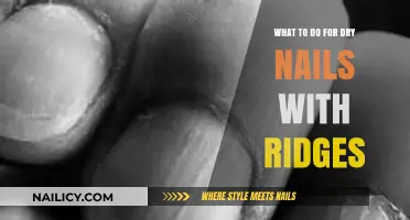 Revive Dry, Ridged Nails: Simple Solutions for Smooth, Healthy Hands