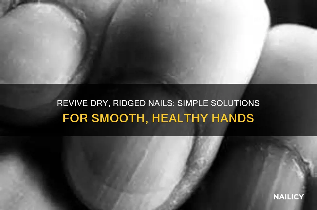 what to do for dry nails with ridges