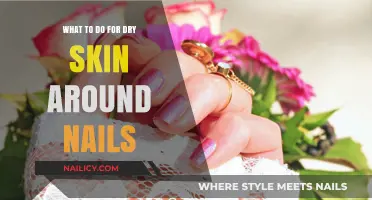 Hydrate and Heal: Effective Remedies for Dry Skin Around Nails
