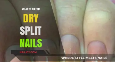Heal and Strengthen: Effective Remedies for Dry, Split Nails