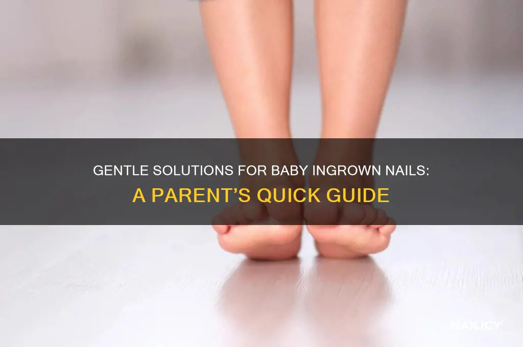 what to do for ingrown nail baby