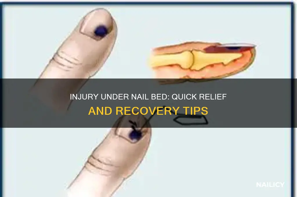 what to do for injury under nail bed