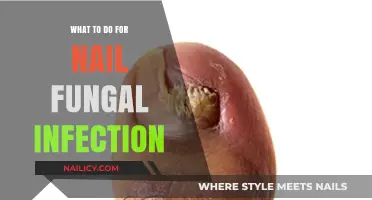 Effective Remedies and Tips to Treat Nail Fungal Infections Fast