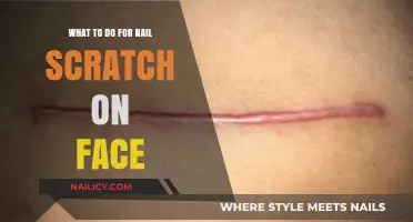 Quick Fixes for Healing a Nail Scratch on Your Face