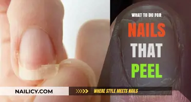 Effective Remedies for Peeling Nails: Restore Strength and Health Fast