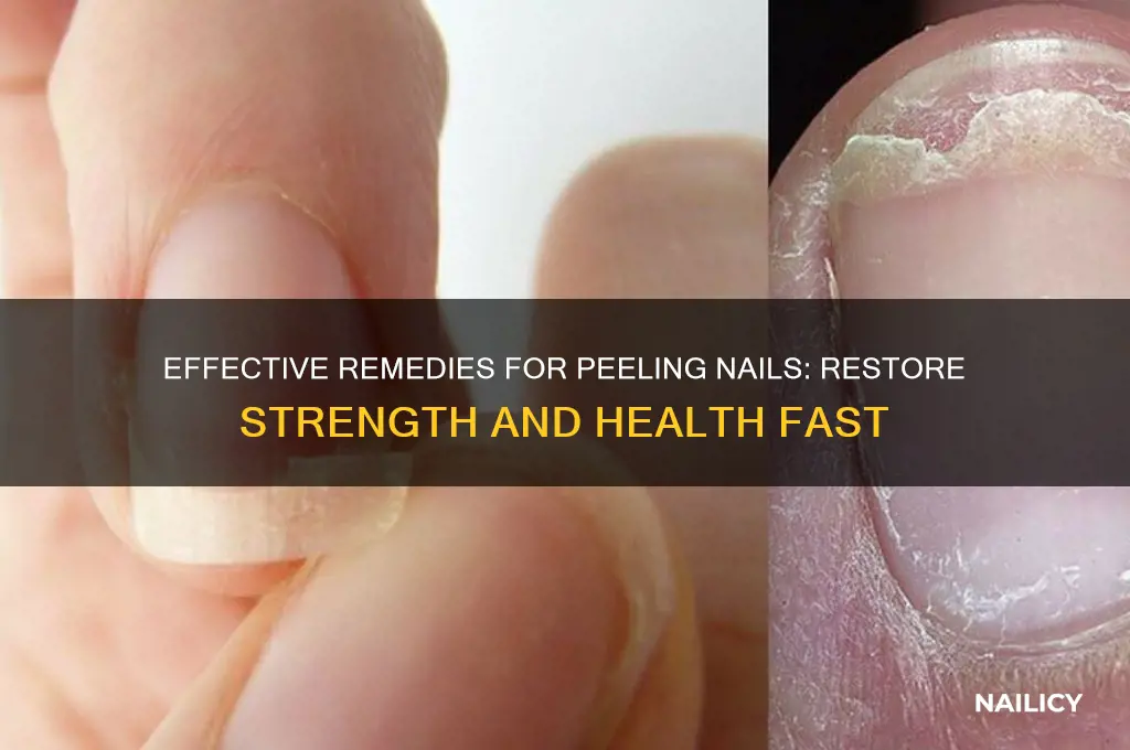 what to do for nails that peel
