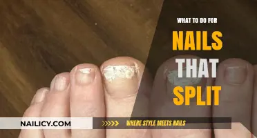 Effective Remedies for Split Nails: Strengthen and Repair with Ease
