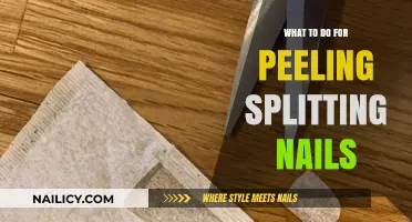 Heal and Strengthen: Solutions for Peeling, Splitting Nails