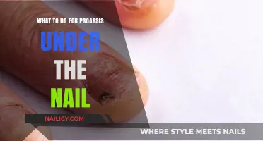 Effective Nail Psoriasis Treatments: Relief and Care Tips for Healthy Nails