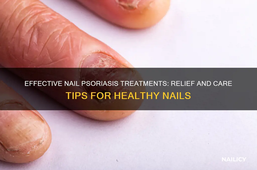 what to do for psoarsis under the nail