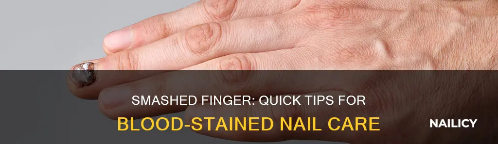 what to do for smashed finger with blood under nail