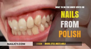 How to Fix White Spots on Nails Caused by Nail Polish