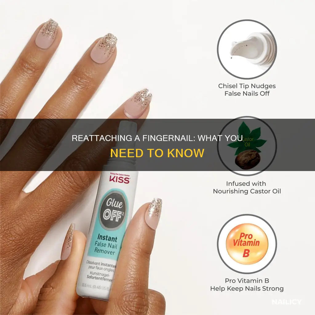 what to do if a finger nail comes off