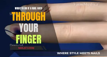 Nail Through Finger: Quick Steps for Immediate Relief