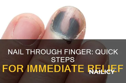 what to do if a nail goes through your finger