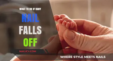Baby Nail Falls Off? Stay Calm and Follow These Gentle Steps