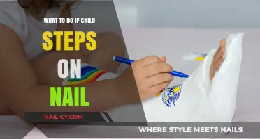 Child Steps on Nail? Quick First Aid and Prevention Tips