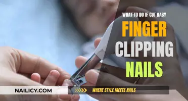 Quick Action Guide: What to Do When Your Baby Cuts Their Finger While Clipping Nails