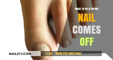 Nail Emergency: Steps to Take When Your Entire Nail Comes Off