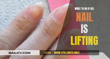 Gel Nail Lifting: Quick Fixes and Long-Term Solutions