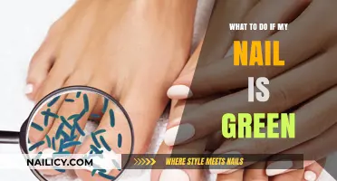 Green Nail? Causes, Concerns, and Quick Fixes for Healthy Nails